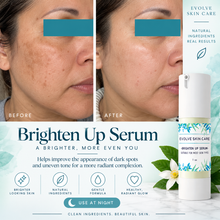 Load image into Gallery viewer, Brighten Up Serum – Fade Dark Spots, Balance Tone & Reveal Radiance