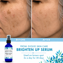 Load image into Gallery viewer, Brighten Up Serum – Fade Dark Spots, Balance Tone & Reveal Radiance
