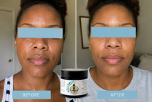 Load image into Gallery viewer, Queen Bee Magic Balm – Herbal Skin Remedy for Radiance, Repair & Protection