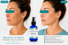 Load image into Gallery viewer, Brighten Up Serum – Fade Dark Spots, Balance Tone &amp; Reveal Radiance
