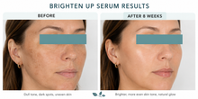 Load image into Gallery viewer, Brighten Up Serum – Fade Dark Spots, Balance Tone &amp; Reveal Radiance
