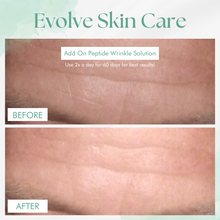 Load image into Gallery viewer, Evolve Skin Care Wrinkle Corrector Serum
